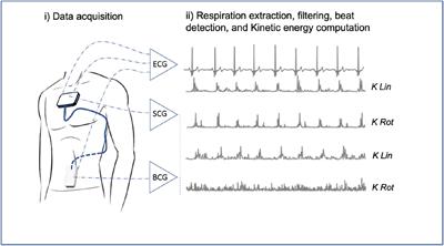 Non-invasive cardiac kinetic energy distribution: a new marker of heart failure with impaired ejection fraction (KINO-HF)